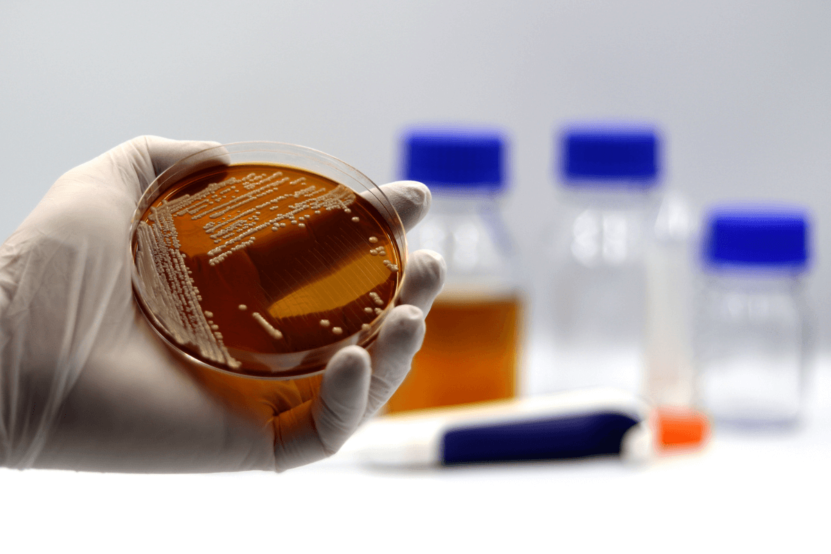 Kaj je kvasovka Saccharomyces boulardii in po čem je posebna